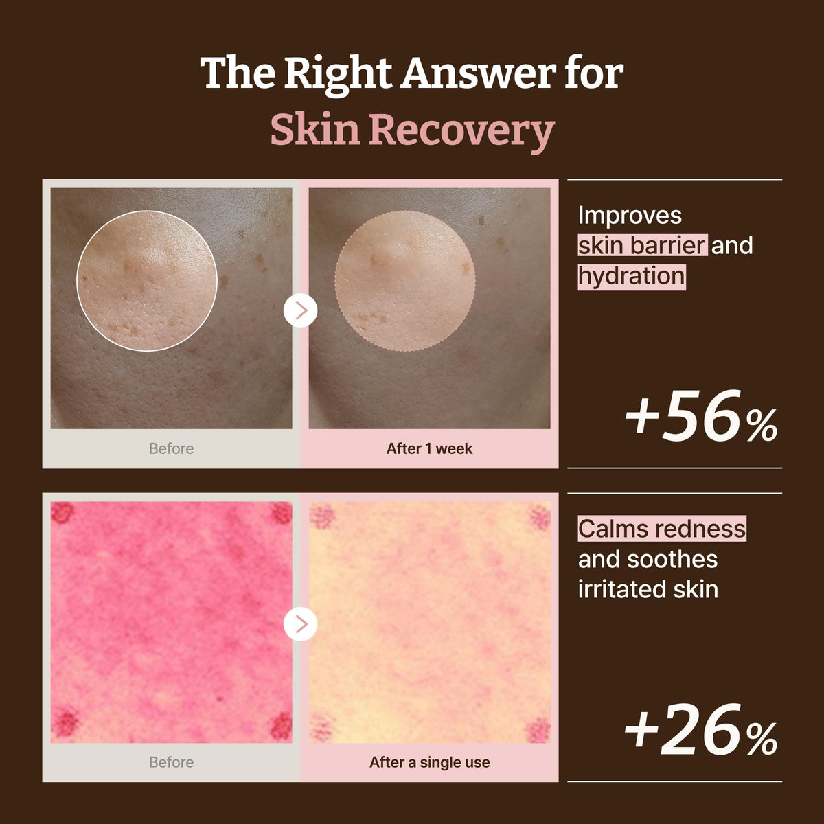 Dr.Reju-All PDRN All-Day Glow Duo: Advanced PDRN Rejuvenating Cream + Advanced PDRN Rejuvenating Mask - Face Moisturizer & Facial Mask for Hydration & Plumping - Korean Skin Care Daily Routine Dr.Reju-All buy supplements Au