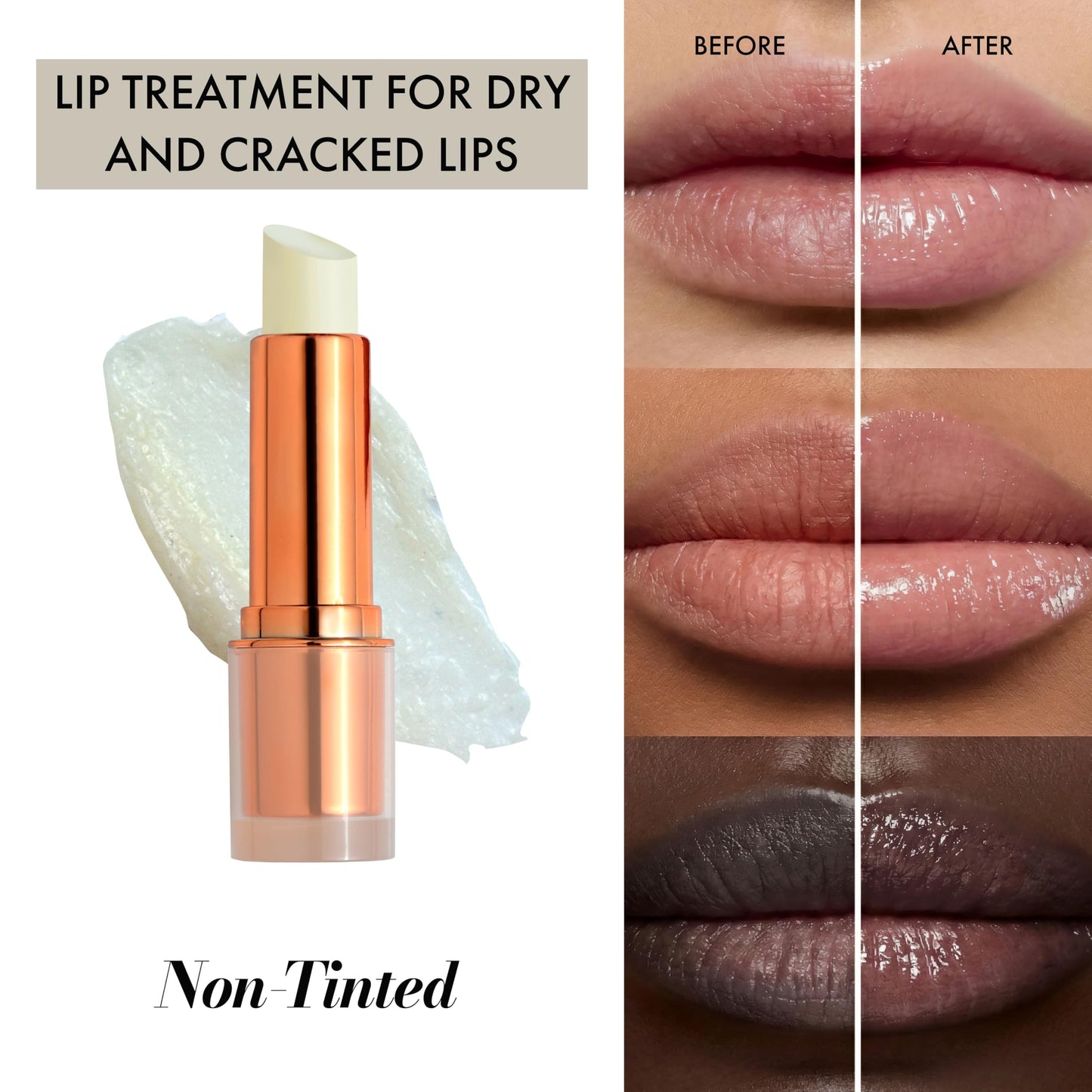 Clinexil Lip Balm – Hydrating Lip Repair with Cold-Pressed Oils, 10% Squalane, Vitamin E & Ceramides