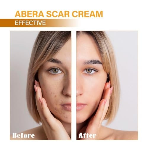ABERA Scar Removal Cream for Women and Men - Rapid Repair of New Old Scars, Spots, Burns All Natural Treatment with Vitamin E, Alanine, Collagen (1 Box + 3 Eye Patch) ABERABuy Supplements Australia