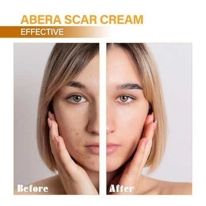 ABERA Scar Removal Cream for Women and Men - Rapid Repair of New Old Scars, Spots, Burns All Natural Treatment with Vitamin E, Alanine, Collagen (1 Box + 3 Eye Patch) ABERABuy Supplements Australia