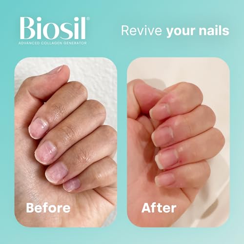 Biosil Collagen Generator - 60 Capsules - with Patented ch-OSA Complex - Generates & Protects BioSilBuy Supplements Australia
