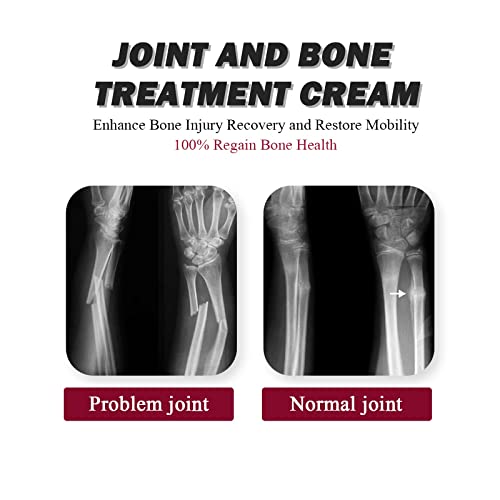 Joint Collagen Relieves Joint Soreness And Body Joint Care Collagen Get Thick Products GenericBuy Supplements Australia