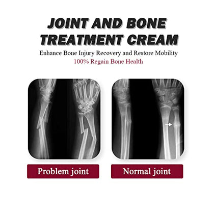 Joint Collagen Relieves Joint Soreness And Body Joint Care Collagen Get Thick Products GenericBuy Supplements Australia