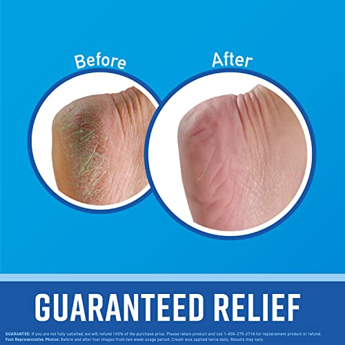 O'Keeffe's for Healthy Feet Foot Cream, 3.0 Ounce Tube and O'Keeffe's for Healthy Feet O'Keeffe'sBuy Supplements Australia