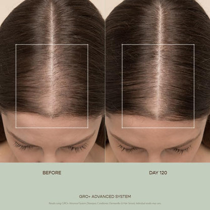VEGAMOUR GRO+ Advanced Balancing Conditioner | Hydrates the Scalp, Nourishes and Softens Hair | For Severe Signs of Thinning | Color Safe, Vegan, Cruelty-Free, Formulated Without Silicones (8 Fl Oz) VEGAMOURBuy Supplements Australia