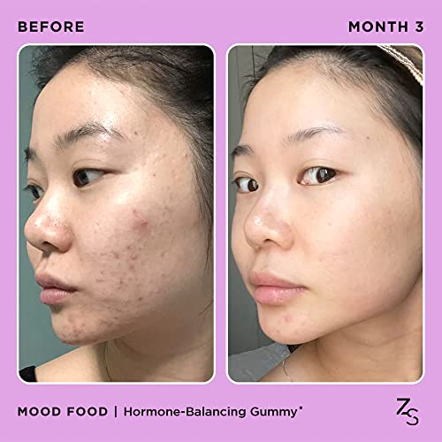ZitSticka Mood Food: Gummy for Moody Skin + PMS Drama, Forest Berry Flavour ZitStickaBuy Supplements Australia