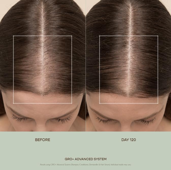 VEGAMOUR GRO+ Advanced Hair Serum for Improving Hair Density, Tonic Reduces Shedding and Promotes a Healthy Scalp, 3 pack VEGAMOURBuy Supplements Australia