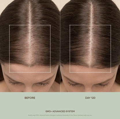 VEGAMOUR GRO+ Advanced Hair Serum for Improving Hair Density, Tonic Reduces Shedding and Promotes a Healthy Scalp, 1 pack VEGAMOURBuy Supplements Australia