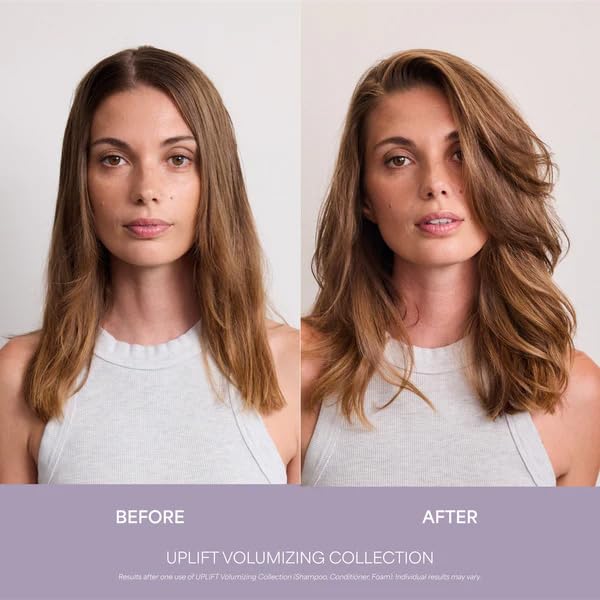 VEGAMOUR UPLIFT and Refresh Kit | Volumizing Dry Shampoo Spray Formulated Without Benzene, Supports Thicker Fuller Looking Hair | $50 Value VEGAMOURBuy Supplements Australia