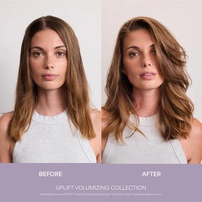 VEGAMOUR UPLIFT and Refresh Kit | Volumizing Dry Shampoo Spray Formulated Without Benzene, Supports Thicker Fuller Looking Hair | $50 Value VEGAMOURBuy Supplements Australia