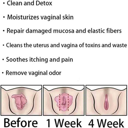 AnnieCare Instant Anti-Itch Detox Products, Annie Care Capsulas, Firming Repair & Pink WeabetBuy Supplements Australia