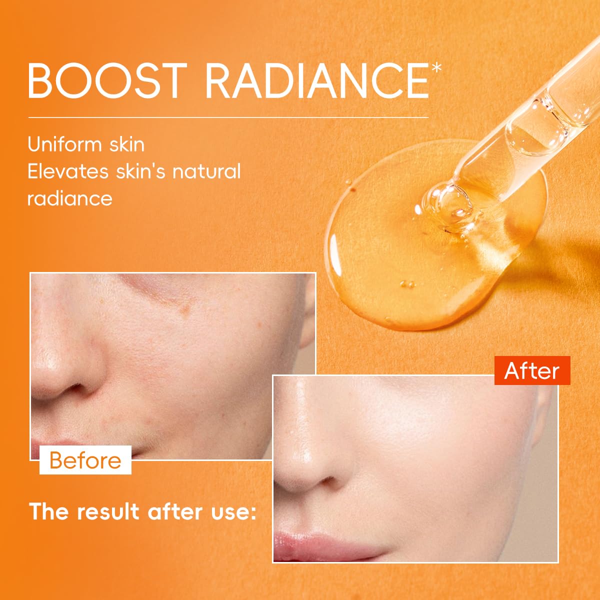 MSMEESUYA Vitamin C Serum for Face 2-Pack, Brightening Facial Serum with Hyaluronic Acid & Vitamin E, Helps Improve Dark Spots, Uneven Tone, Fine Lines & Wrinkles, 1 Fl Oz Each MSMEESUYA buy supplements Au