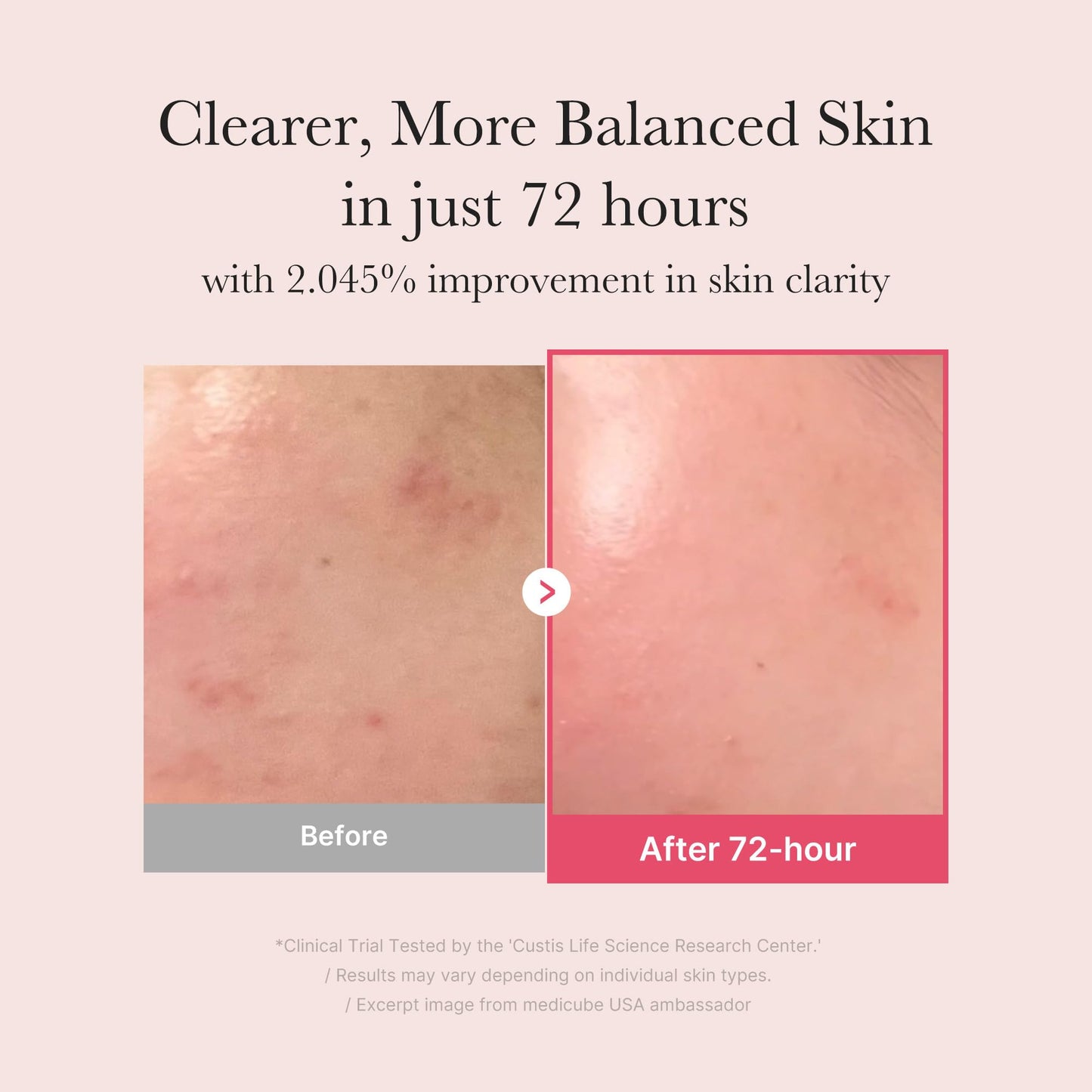 medicube TXA+Niacinamide 15% Glow Facial Serum for After Spot Care | All-in-One Daily