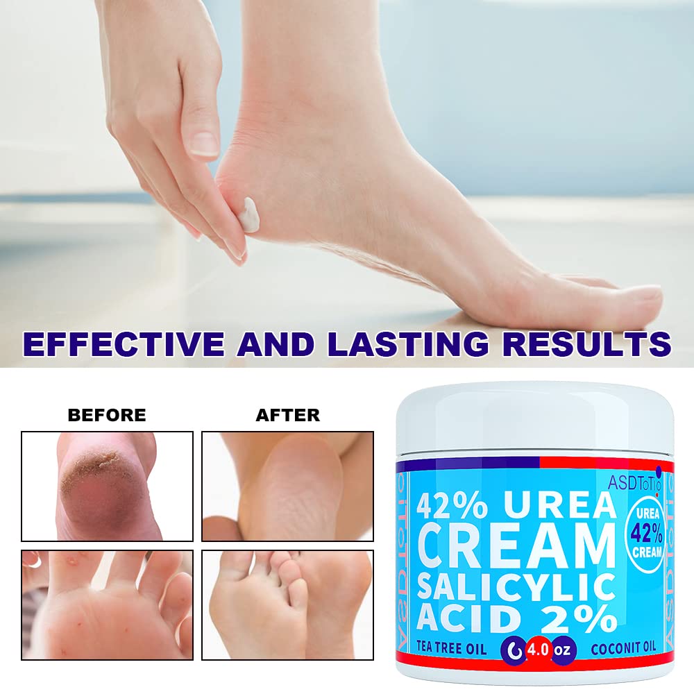 ASDToTio Urea Cream 42% - Premium Urea Foot Cream - With 2% Salicylic Acid, Tea Tree Oil, Shea Butter, Aloe Vera - For Feet, Hands, Heels, Elbows, Knees and More - 4 oz ASDToTio buy supplements Au