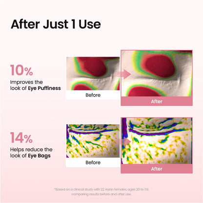 BIODANCE Collagen Peptide Eye Patches, Anti Wrinkle & Smile Line Patches for Face, Under Eye Mask for Fine Lines & Eye Bags