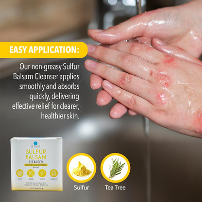 Dr. Robaina Sulfur Balsam Cleansing Bar – Face & Body Soap for Oily, Acne-Prone or Itchy Skin – Gently Exfoliates, Calms Redness & Removes Excess Oil – Tea Tree, Calendula & Shea, 4 oz Dr. Robaina buy supplements Au