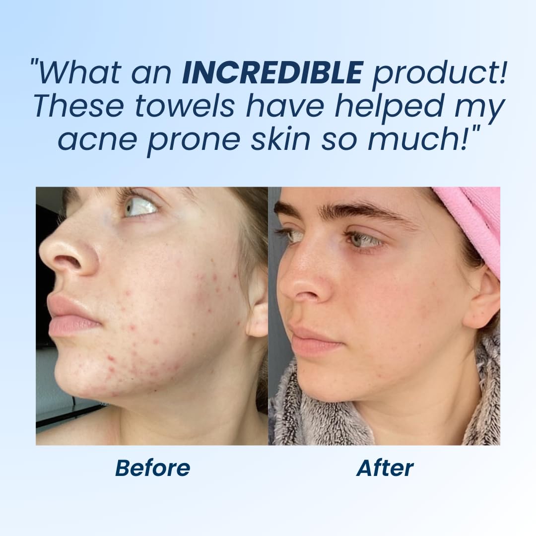 Clean Skin Club Clean Towels XL, 100% USDA Biobased Dermatologist Appr CLEAN SKIN CLUBBuy Supplements Australia
