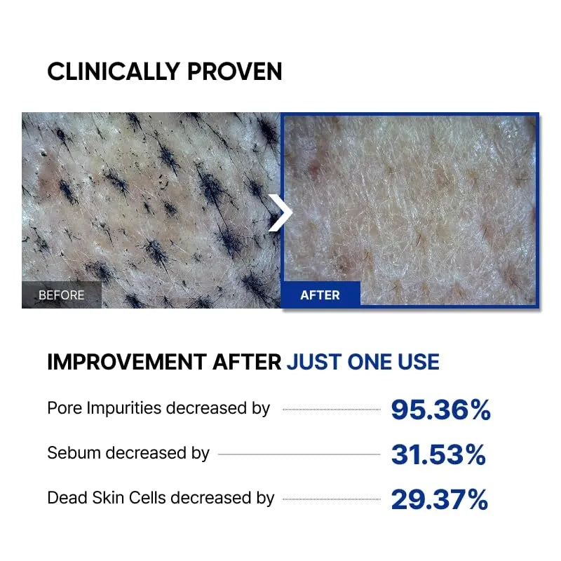 SAYNID MICROBIOME RENEWING CREAM MASK TRIAL KIT, Wash-off Cream, Soft Exfoliating Face Scrub Dead Skin Cells | 4.5g/0.15oz (3EA) SAYNIDBuy Supplements Australia