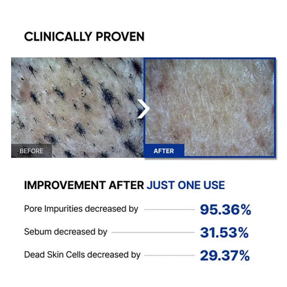 SAYNID MICROBIOME RENEWING CREAM MASK TRIAL KIT, Wash-off Cream, Soft Exfoliating Face Scrub Dead Skin Cells | 4.5g/0.15oz (3EA) SAYNIDBuy Supplements Australia