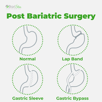 BariSlim Bariatric Calcium Citrate Plus Powder - Formulated for Patients After Weight Loss BariSlimBuy Supplements Australia