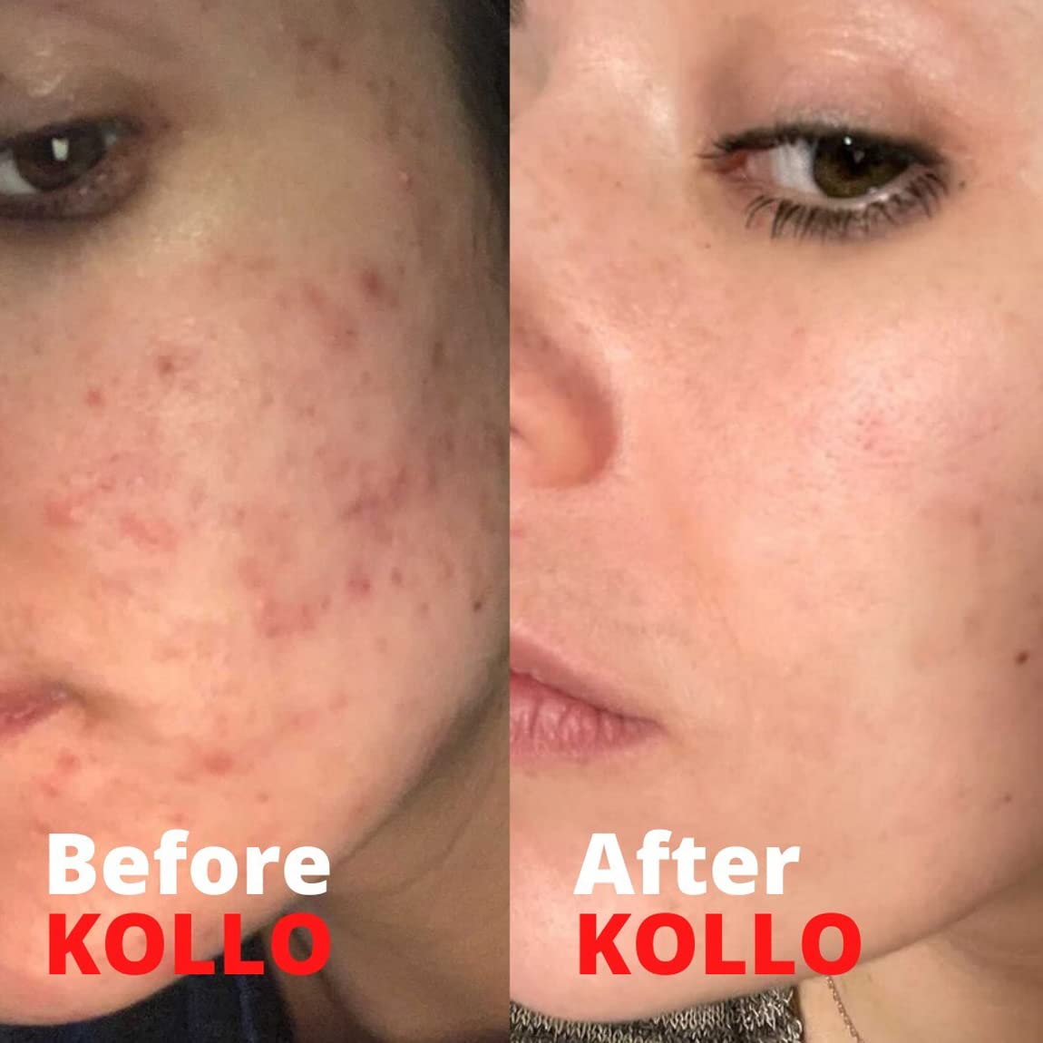 Kollo Premium Marine Collagen Liquid, 10,000 mg - Essential Proteins Collagen Peptides KolloBuy Supplements Australia