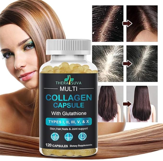 TheraSuva Complete Multi Collagen Complex – Types I, II, III, V & X + Biotin & Vitamin C – Hair, Skin, Nails & Joint Support, 2 Month Supply, 120 Softgels TheraSuva buy supplements Au