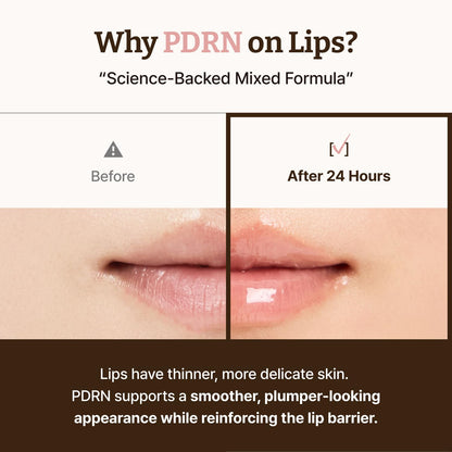 Dr. Reju-All Advanced PDRN Rejuvenating Lip Serum – Hydrating Lip Balm with Lipozip PDRN for Glowy, Dewy Lips