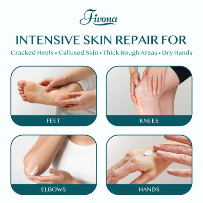 FIVONA 42% Urea Foot Cream for Thick, Rough Dry Skin - Maximum Strength Callus Softening with 2% Salicylic Acid, Tea Tree & Aloe Vera, 100g (3.5 oz) - Deep Moisturizing Foot Care FIVONA buy supplements Au