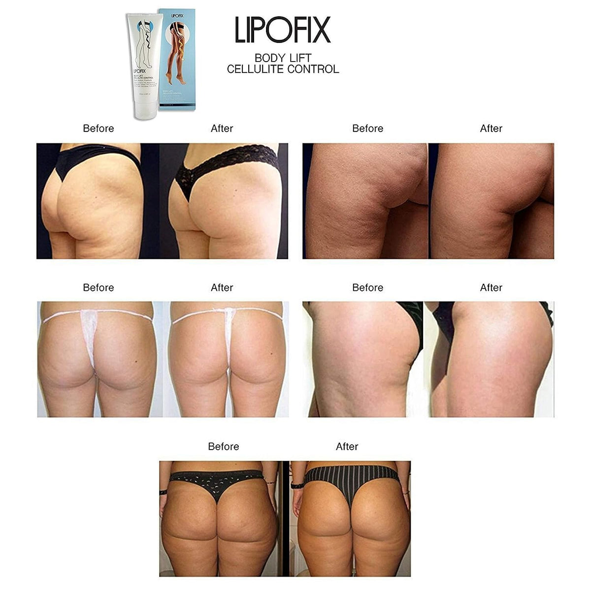 LIPOFIX Anti Cellulite Cream Luxurious Formula Body Contour Cream Effectively Tone LIPOFIXBuy Supplements Australia