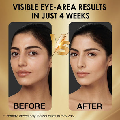 NIAWIT Eye Serum – Anti-Fatigue Eye Care for Dark Circles, Puffiness & Fine Lines with Niacinamide, Peptides & Caffeine – Gentle Clean Beautiful for Daily Use Around the Delicate Eye Area NIAWIT buy supplements Au
