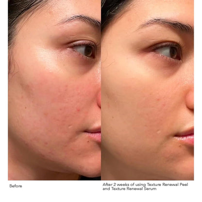 Dr. Dennis Gross Advanced Retinol + Ferulic Texture Renewal Serum – Anti-Aging Formula to Smooth Texture, Boost Radiance, and Minimize Fine Lines & Wrinkles, 1 oz Dr Dennis Gross buy supplements Au