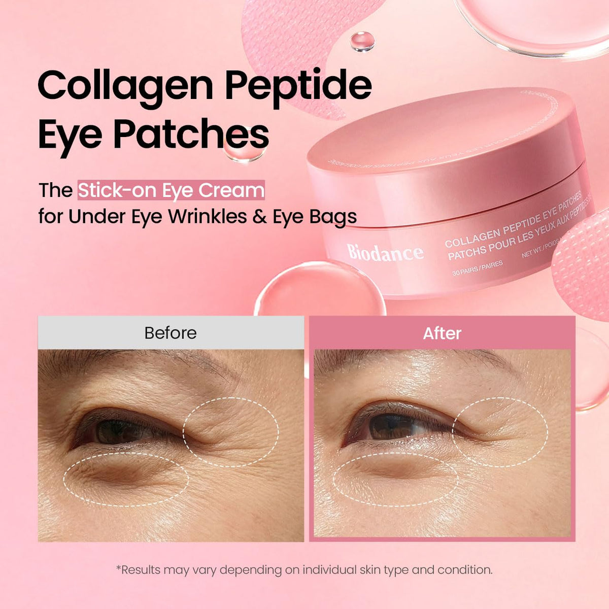 BIODANCE Collagen Peptide Eye Patches, Anti Wrinkle & Smile Line Patches for Face, Under Eye Mask for Fine Lines & Eye Bags