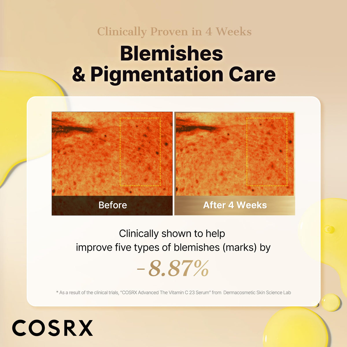 COSRX Advanced Pure Vitamin C 23% Serum with Vitamin E & Glutathione, Korean Vitamin C Serum for Fine Lines, Uneven Skin Tone & Dull Skin, 0.7oz, Korean Skin Care, Mothers Day Gifts for Mom & Wife COSRX buy supplements Au