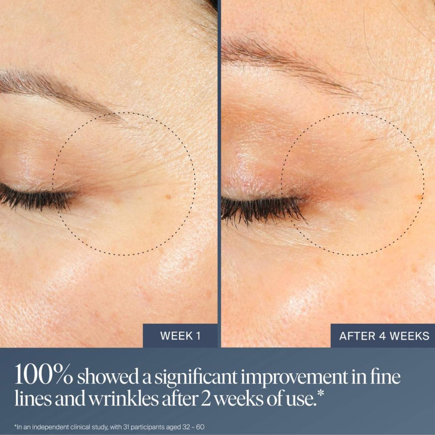 Summer Fridays Jet Lag Overnight Eye Serum - Nourishing Undereye Treatment for Dark Circles - Helps to Hydrate, Smooth, Firm & Depuff - Enriched with Glycerin to Lock in Moisture (0.5 Fl Oz) Summer Fridays buy supplements Au
