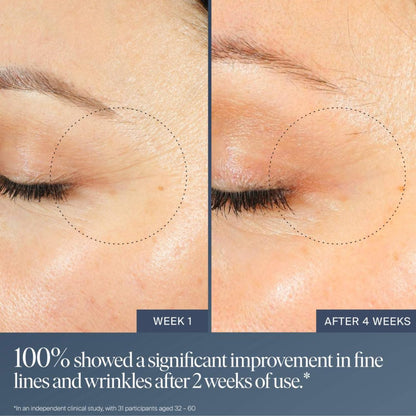 Summer Fridays Jet Lag Overnight Eye Serum - Nourishing Undereye Treatment for Dark Circles - Helps to Hydrate, Smooth, Firm & Depuff - Enriched with Glycerin to Lock in Moisture (0.5 Fl Oz) Summer Fridays buy supplements Au