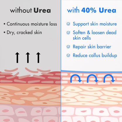Ebanel Urea Cream 40% plus Salicylic Acid 2%, Foot Cream for Dry Cracked Heels Feet Knees Elbows Hands, Foot Dead Skin Cuticle Callus Remover Toenail Softener, Keratolytic Skin Barrier Repair, 2-Pack Ebanel buy supplements Au
