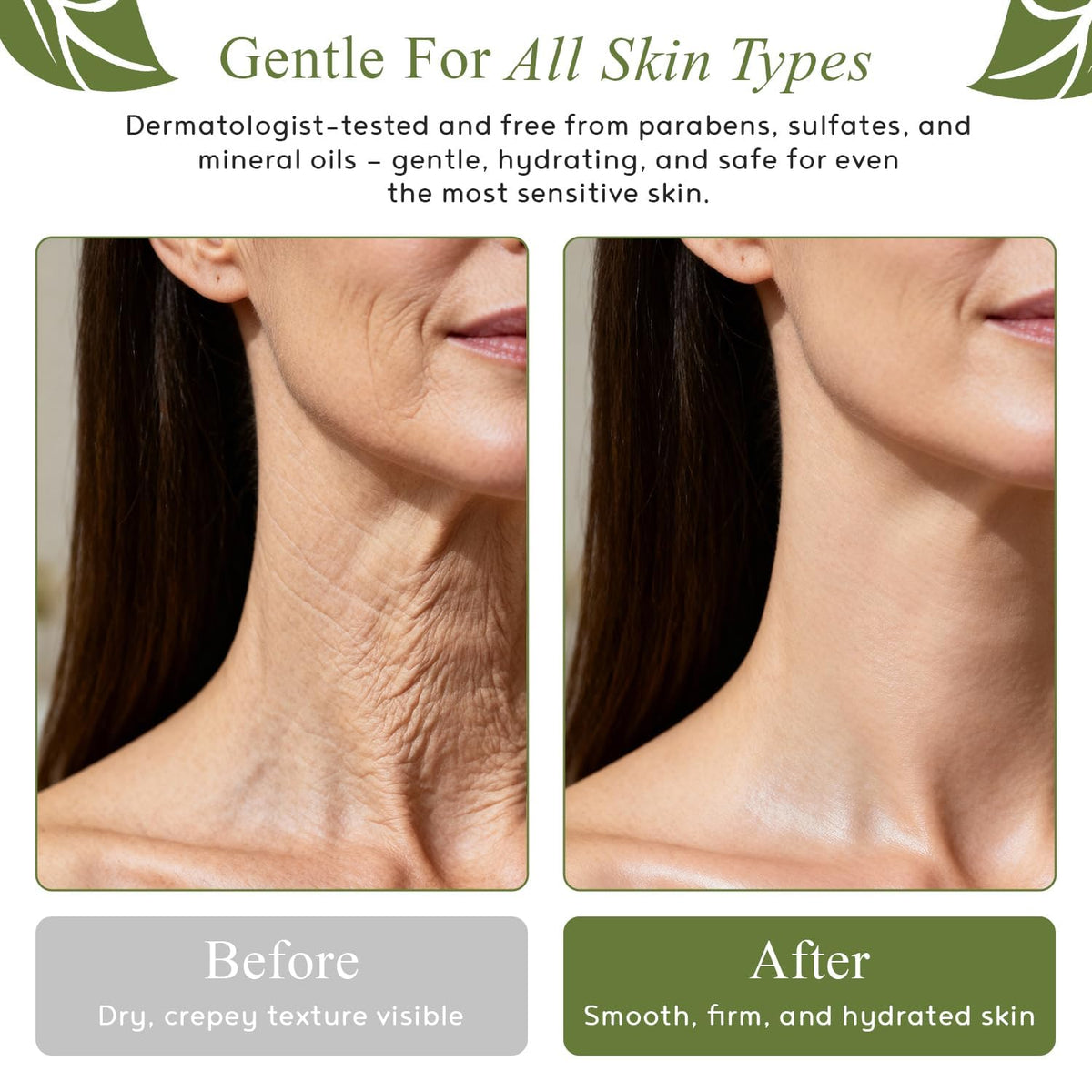 M.D. Blend Crepe-Ease Body Moisturizer Anti Aging Retinol Cream Firming, Smoothing & Hydrating Cream for Crepey Skin on Neck, Arms & Legs Crepe Skin Repair, Advanced Crepe Fix, 4 oz M.D. Blend buy supplements Au