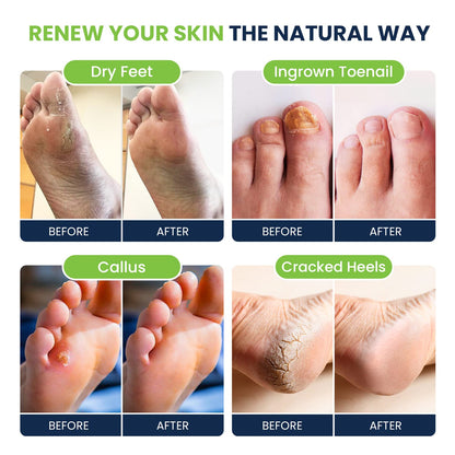 Foot Soak with Epsom Salts- Variety Pack of 4- Tea Tree Oil, Muscle Relief, Calming FOOT CUREBuy Supplements Australia