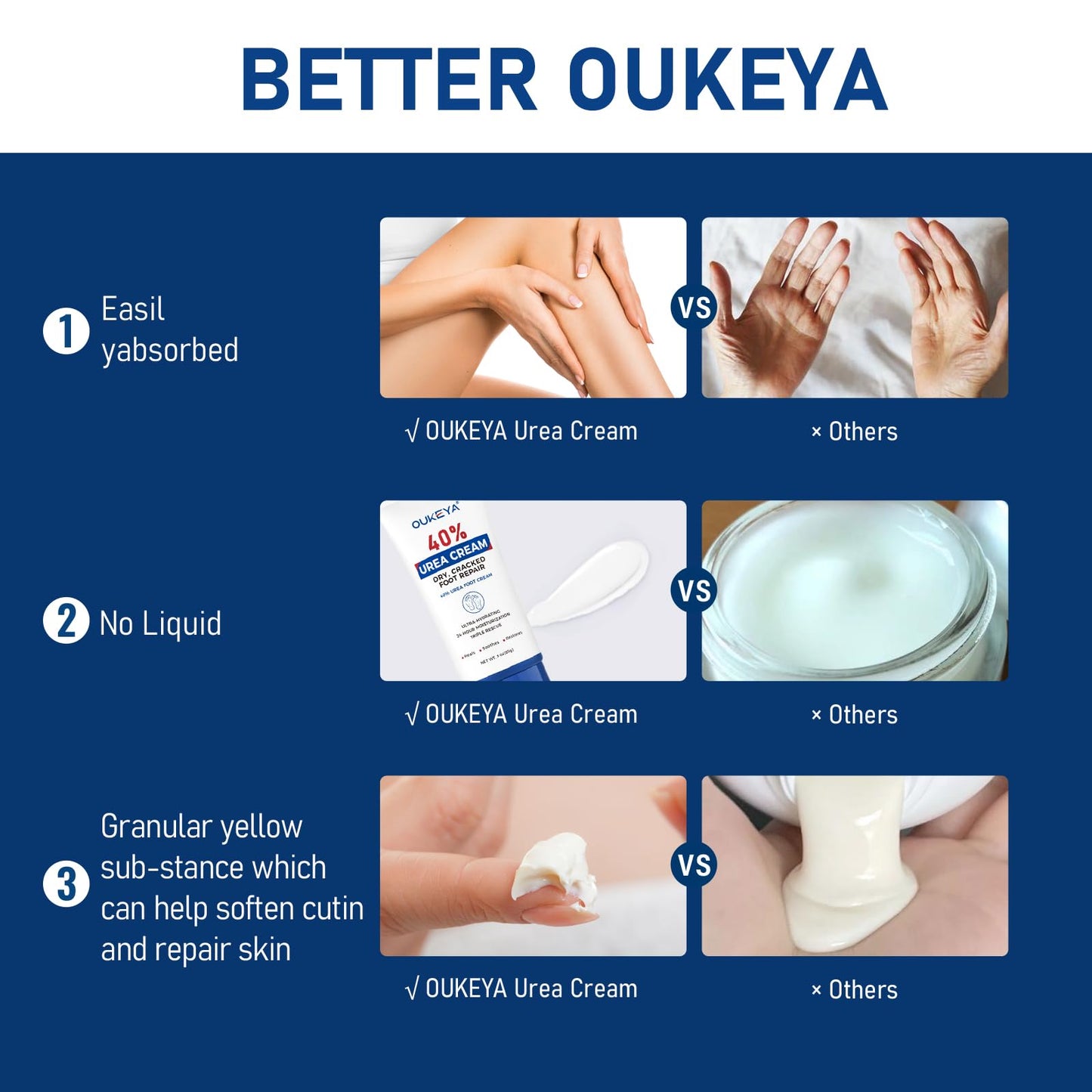 OUKEYA Urea Cream 40 Percent Tube 3 Oz, Foot & Hand Cream for Dry Cracked, 40 per Urea Lotion for Feet Maximum Strength OUKEYA buy supplements Au