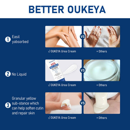 OUKEYA Urea Cream 40 Percent Tube 3 Oz, Foot & Hand Cream for Dry Cracked, 40 per Urea Lotion for Feet Maximum Strength OUKEYA buy supplements Au