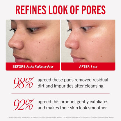 First Aid Beauty - Facial Radiance Pads with Glycolic & Lactic Acids, Daily Exfoliating Pads