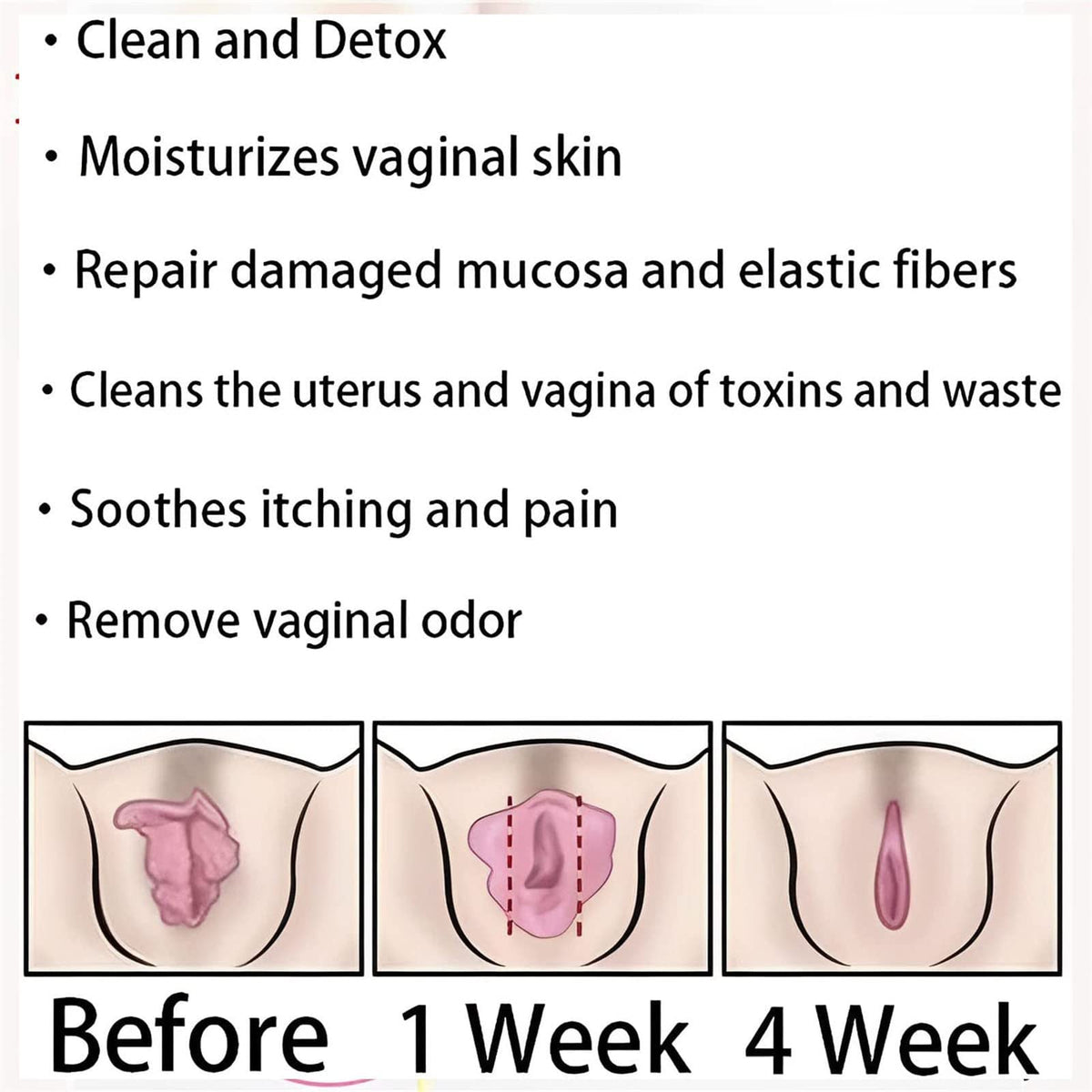 AnnieCare Instant Anti-Itch Detox Slimming Products, Annie Care Natural Detox Viginal Gel DASHENRANBuy Supplements Australia