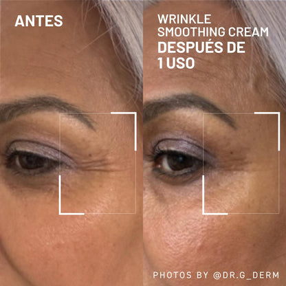 Dr. Brandt Needles No More Wrinkle Smoothing Cream - Smooths Expression Lines, Firms & Protects the Skin - 0.5 oz Dr. Brandt Skincare buy supplements Au