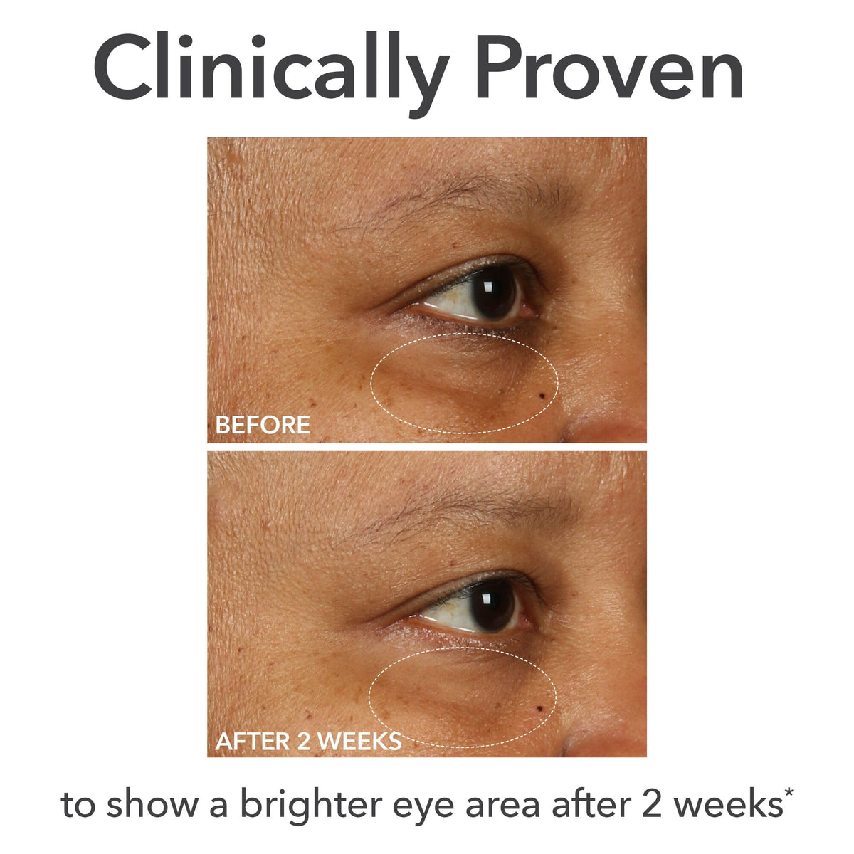 Dr Dennis Gross DermInfusions Fill + Repair Eye Cream: Hydrating & Brightening Treatment for Dark Circles, Fine Lines & Wrinkles, Firms & Smooths 360° Eye Area, 0.5 Oz Dr Dennis Gross buy supplements Au