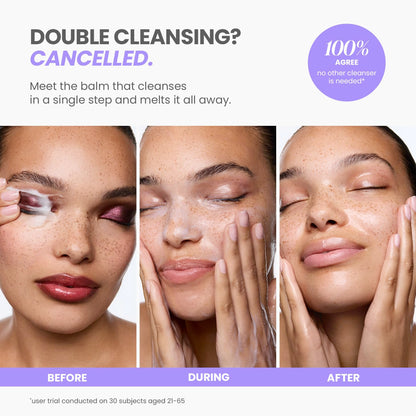 Wonderskin Cleansing Balm - Melt It All Balm to Milk Makeup Remover, Gentle Hydrating Face Cleanser with Centella and Chamomile Wonderskin buy supplements Au