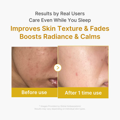 medicube Wrapping Mask Kojic Acid, Turmeric, Vitamin C Overnight Peel Off Facial Mask | Brighten & Defends Against Skin Stress for a Clear, Glowing Complexion | Korean Skin Care, 2.53 fl.oz medicube buy supplements Au