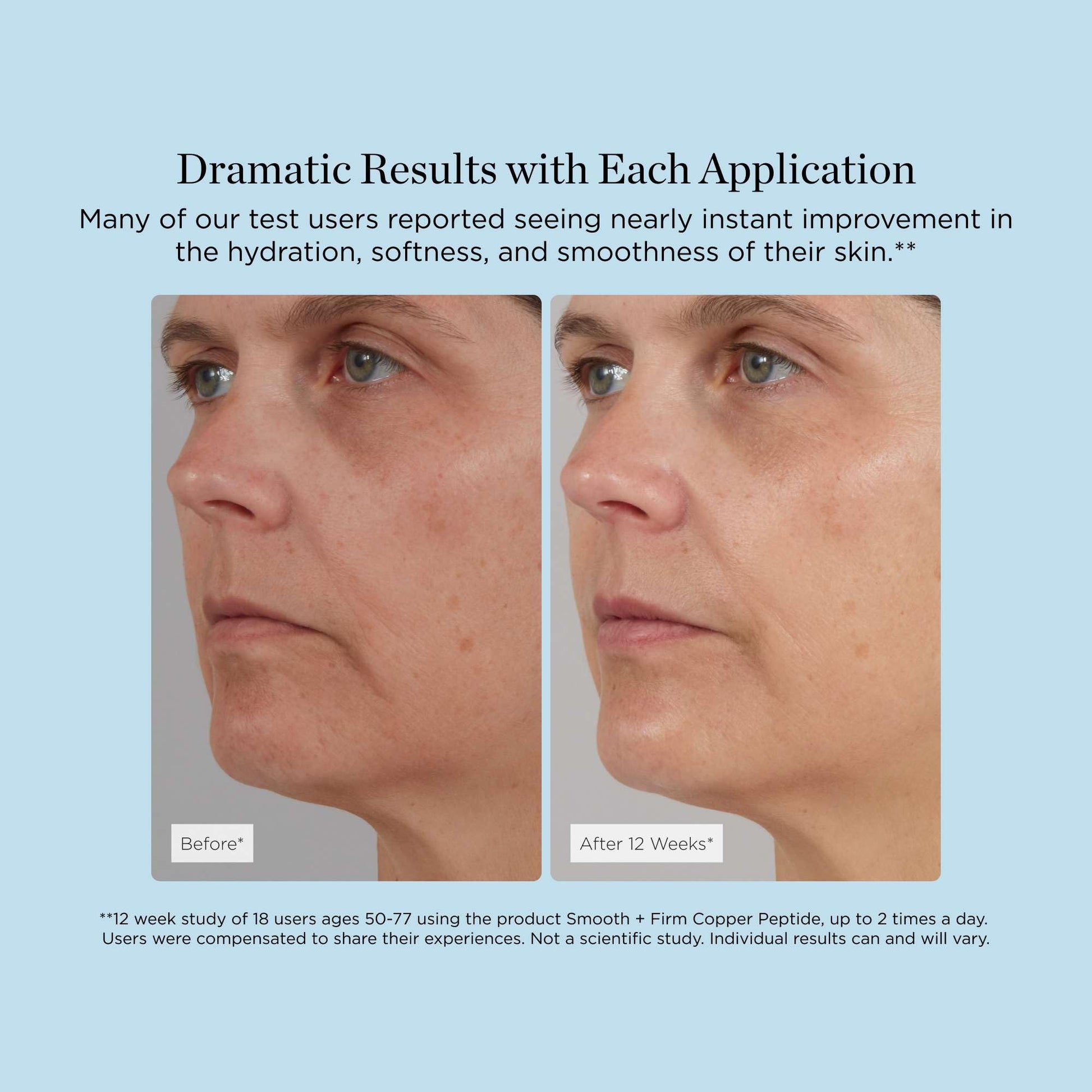 Smooth + Firm Copper Peptide Concentrate Serum for Aging Skin, Plumping Niacinamide for Tightening & Brightening, Helps Improve Elasticity, Hyperpigmentation & Dark Spots, Water Based, 1.18 Fl Oz Beverly Hills MD buy supplements Au