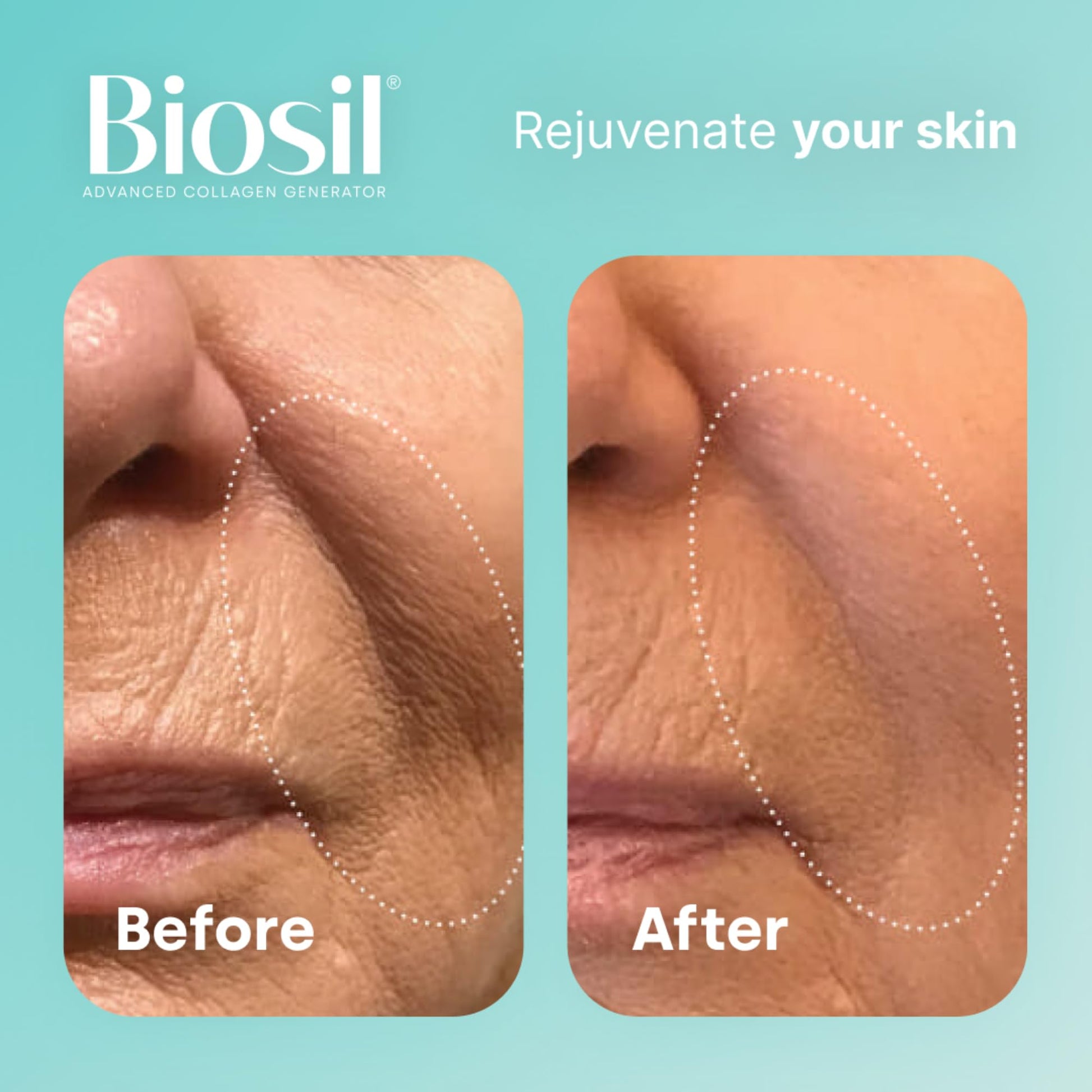 Biosil Collagen Generator - 30 mL Drops - with Patented ch-OSA Complex BioSilBuy Supplements Australia