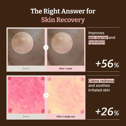 Dr.Reju-All PDRN All-Day Glow Duo: Advanced PDRN Rejuvenating Cream + Advanced PDRN Rejuvenating Mask - Face Moisturizer & Facial Mask for Hydration & Plumping - Korean Skin Care Daily Routine Dr.Reju-All buy supplements Au