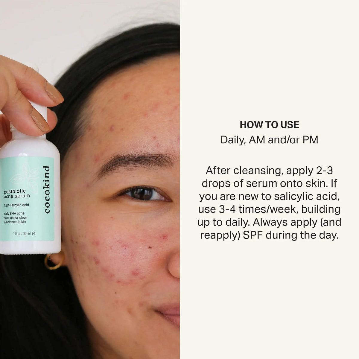 Cocokind Postbiotic Acne Serum, Salicylic Acid Serum and BHA Liquid Exfoliant - Exfoliating, Brightening and Hydrating Serum CocokindBuy Supplements Australia